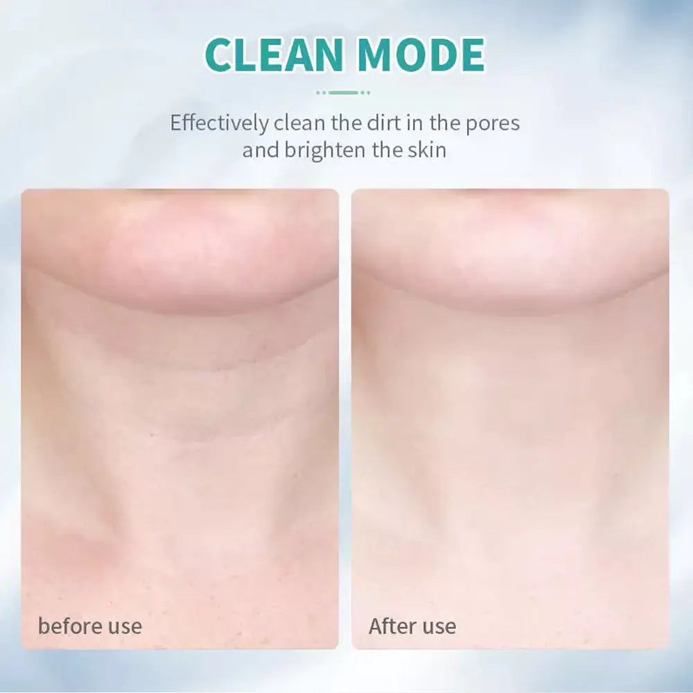 SmoothPro | Massagegerät für Gesicht und Hals